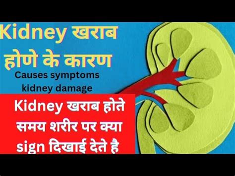 Kidney Damage Kidney Damage Symptoms Kidney Damage Hone Ke Lakshan