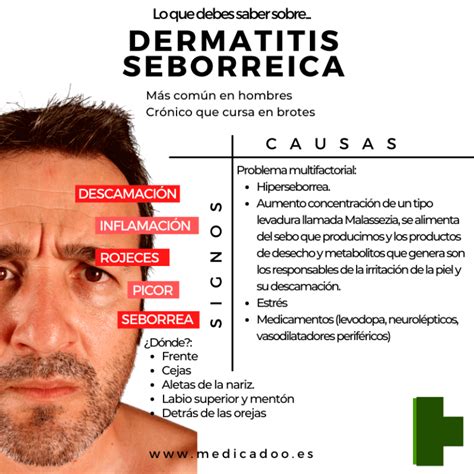 Dermatitis Seborreica Causas Tratamiento Y Prevención