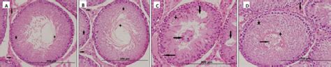 H And E Stained Sections Of Testis A Control Normal Testicular