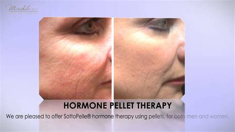 The Safest Hormone Pellet Therapy In Kansas City Youtube