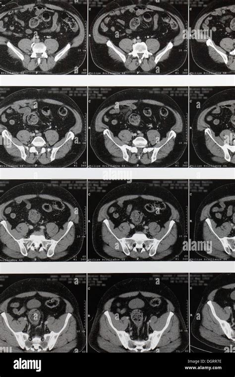 Multi Slice Computed Tomography Magnetic Resonance Imaging Mri