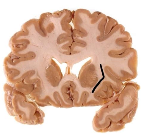 Neuroanatomy Labs 1 2 Flashcards Quizlet