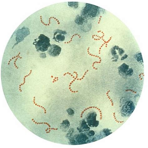 Argentina Qu Tan Peligrosa Es La Bacteria Streptococcus Pyogenes Que