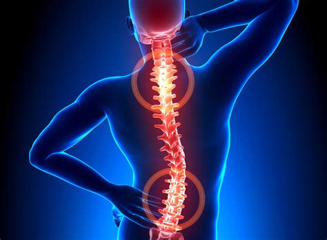 Kyphoplasty A Minimally Invasive Treatment For Major Back Pain Weiss