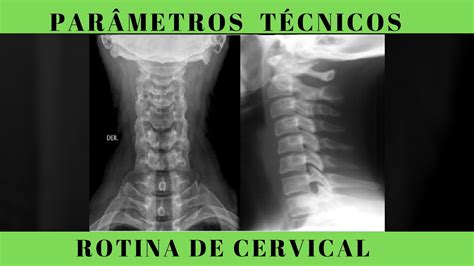 Rotina De Coluna Cervical Avalia O Dos Padr Es T Cnicos Anatomia