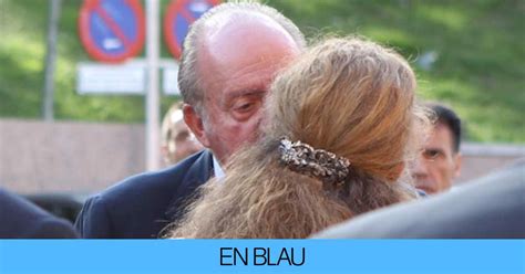 Juan Carlos tiene una nueva cara revelan qué se ha hecho ha pasado