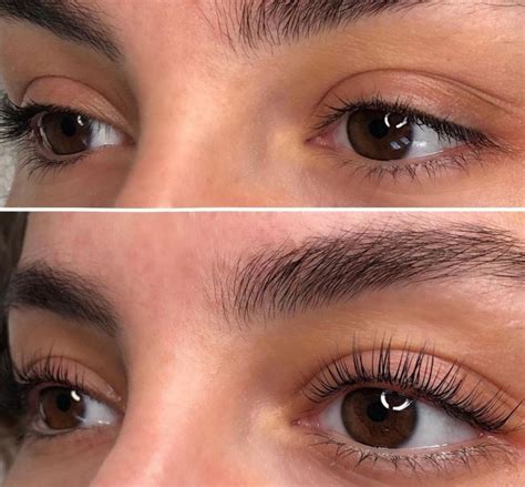 Lash lift rehaussement de cils coûts durée résultats