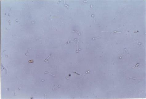 Germ Tube Test Of C Albicans D56 40x Download Scientific Diagram