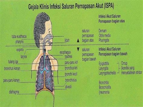 Ispa Infeksi Saluran Pernapasan Akut