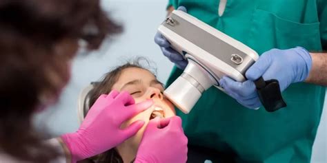 Süt dişlerine Kanal Tedavisi Yapılır Mı Metco Dental