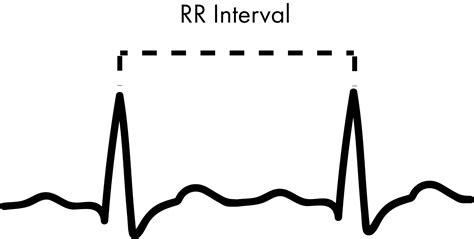 Heart Rate Variability How To Analyze Ecg Data Imotions