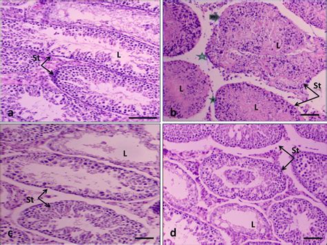 Ad Light Micrographs Of Cross Sections Of The Testes Of Rat Stained