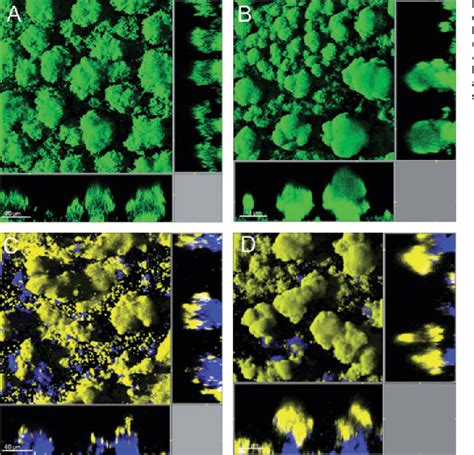 Roles Of Type IV Pili Flagellum Mediated Motility And Extracellular