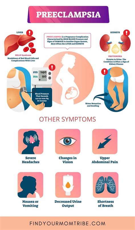 Preeclampsia Signs