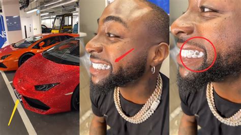 Davido Splash K On A Diamond Teeth And Set To Ship In A Customized