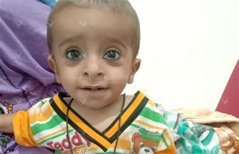 Donate for Suffiyan’s VSD Closure Surgery