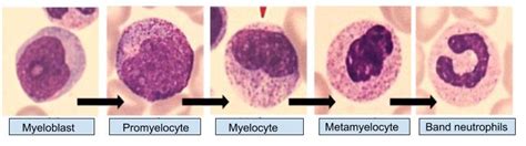 Examples Of Maturation Stages Of Wbc Type Including Myeloblast