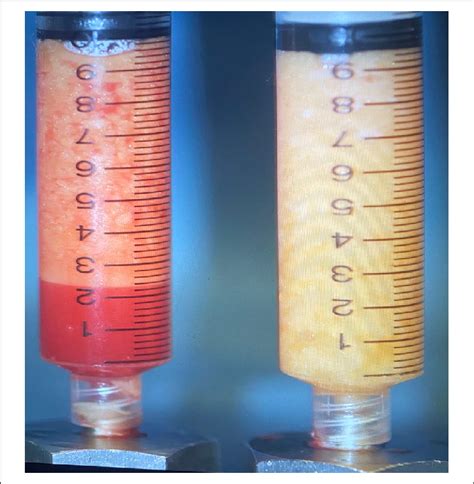 Fat Harvested From The Same Patient Download Scientific Diagram
