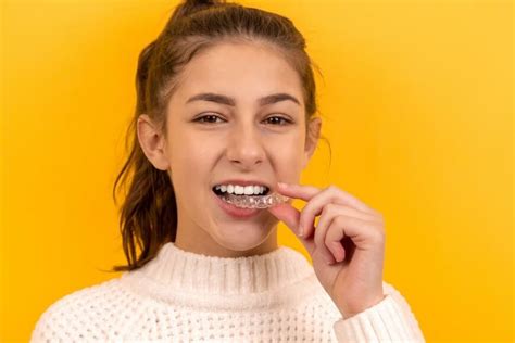 Invisalign vs. Braces: The Complete Rundown