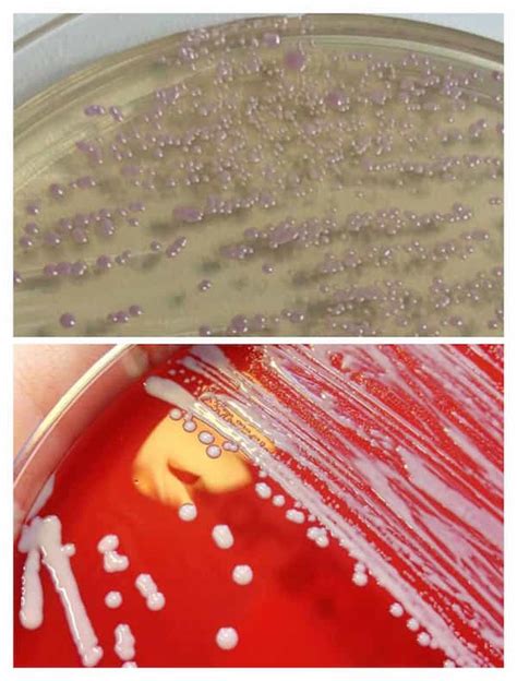 Staphylococcus Saprophyticus Classification Clinical Manifestations