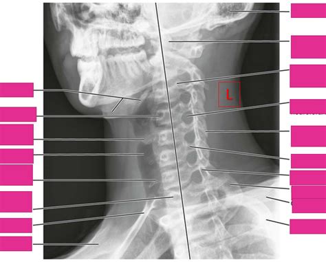 Cervical Oblique Lao Diagram Quizlet