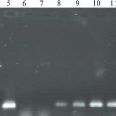 Electrophoresis Separation 1 Wt Vol Agarose Gel Of The PCR