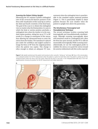 Nuchal Translucency Measurement On The Fetus In A Difficult Position PDF