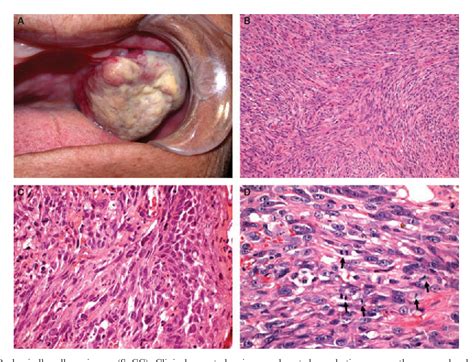 Figure From Clinicopathological And Immunohistochemical Features Of