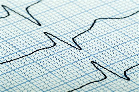 cardiogram of heart beat 1360289 Stock Photo at Vecteezy