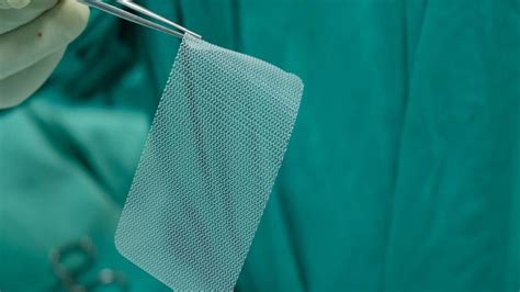 Hernia Mesh, how a patch can torment your body after surgery - Safety Watch