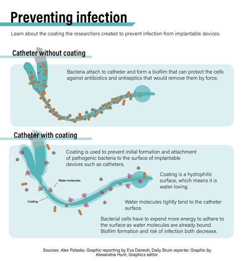 UCLA Professors Company Creates New Antibacterial Coating For Medical