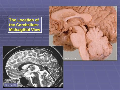 The Motor Regulator 2 The Cerebellum Impact Factor