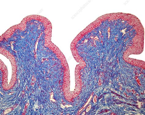 Urinary Bladder Mucosa Light Micrograph Stock Image C