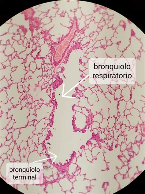 TP16 Histología del aparato respiratorio