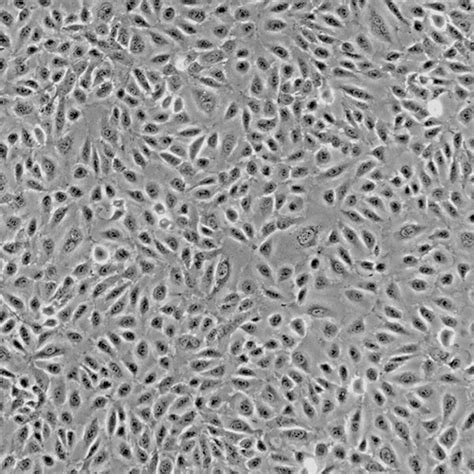 Human Umbilical Vein Endothelial Cells Innoprot Umbilical Cell System