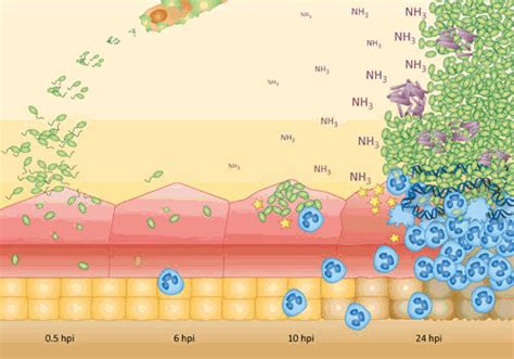 Pathogenesis Of Proteus Mirabilis Infection Ecosal Plus