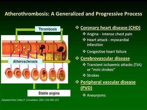 Lower Levels Of Adamts Are Associated With Cardiovascular Disease By