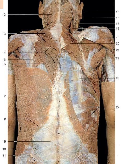 Extrinsic Back Muscles Cadaver Anatomy Diagram Quizlet The Best Porn