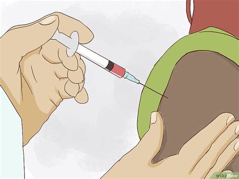 Como Dar Uma Injeção De B12 15 Passos Com Imagens