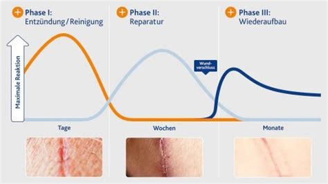 Wundheilungsphasen In 3 Schritten Zur Heilung Bepanthen