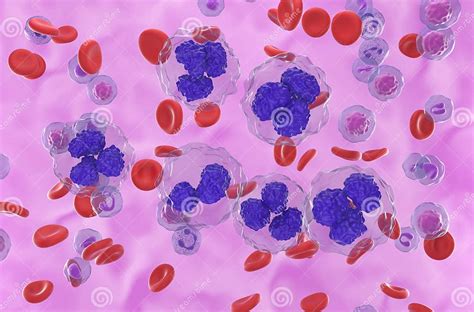 Follicular Lymphoma Fl Cells In Blood Flow Isometric View 3d
