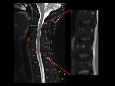 Premium Fat Free Pediatric Spine Imaging Philips Mr Body Map