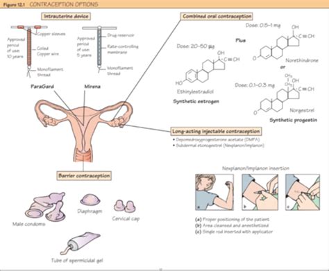 Contraception Flashcards Quizlet