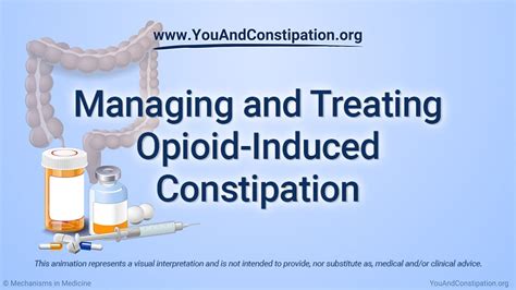 Managing And Treating Opioid Induced Constipation Oic Iffgd