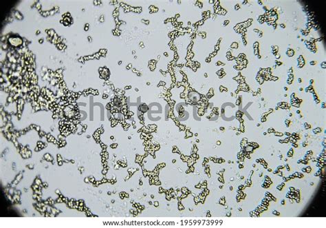 6623 Mold Microscope Images Stock Photos And Vectors Shutterstock