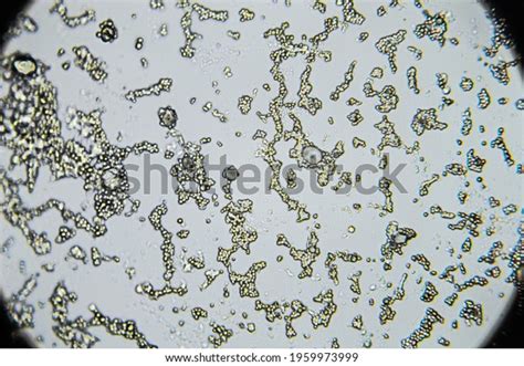 6,623 Mold Microscope Images, Stock Photos & Vectors | Shutterstock