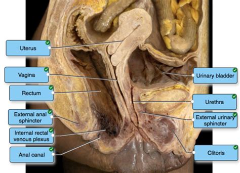 Pelvis Viscera Flashcards Quizlet