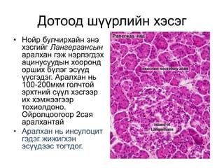 нойр булчирхайн хорт хавдар | PPT