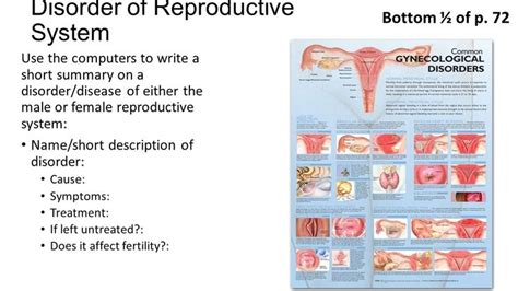 Female Reproductive System Disorders And Diseases Presentation Set Up