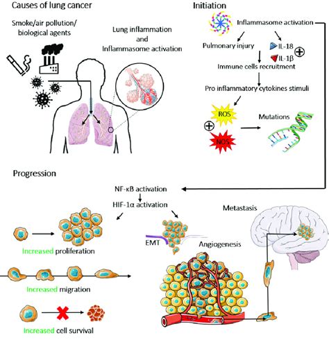 The Role Of Inflammasomes In Lung Cancer Initiation Progression And